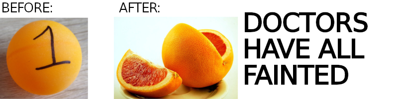A before-and-after comparison; before is an orange with the number "1" written on it ("D1 ball" by Not whamer100, CC BY-SA 4.0 <https://creativecommons.org/licenses/by-sa/4.0>, via Wikimedia Commons), after is the same orange with a slice cut out. Next to the comparison is text reading "DOCTORS HAVE ALL FAINTED".